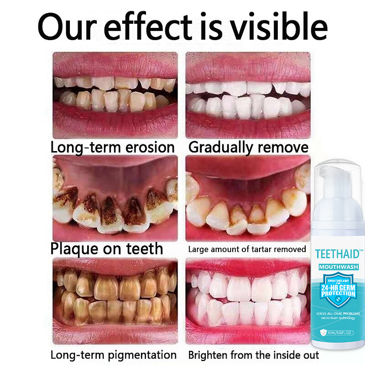 Teethaid⢠Pure Herbal Super Whitening & Teeth & Mouth Repair Mousse