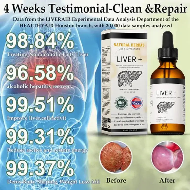 AnnieCare® Natürliches Kräuter-Lebersupplement - Starke Leberunterstützung - Entgiftung & Regeneration - Senkt Blutzucker und Blutfette