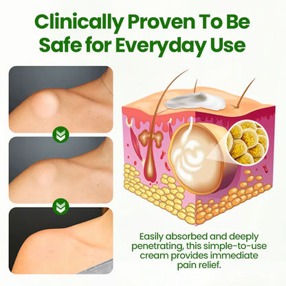 ⏰Last Day Promotion: 60% OFF🔥AnnieCare® KnotAway Lipoma Removal Cream