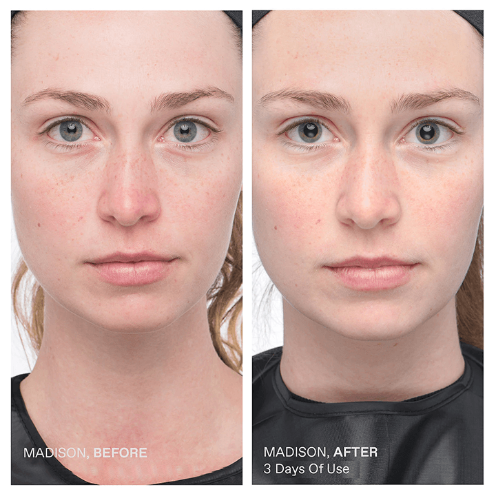 Gold & Aloe Combo Mud Mask